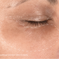 melanopro peel system