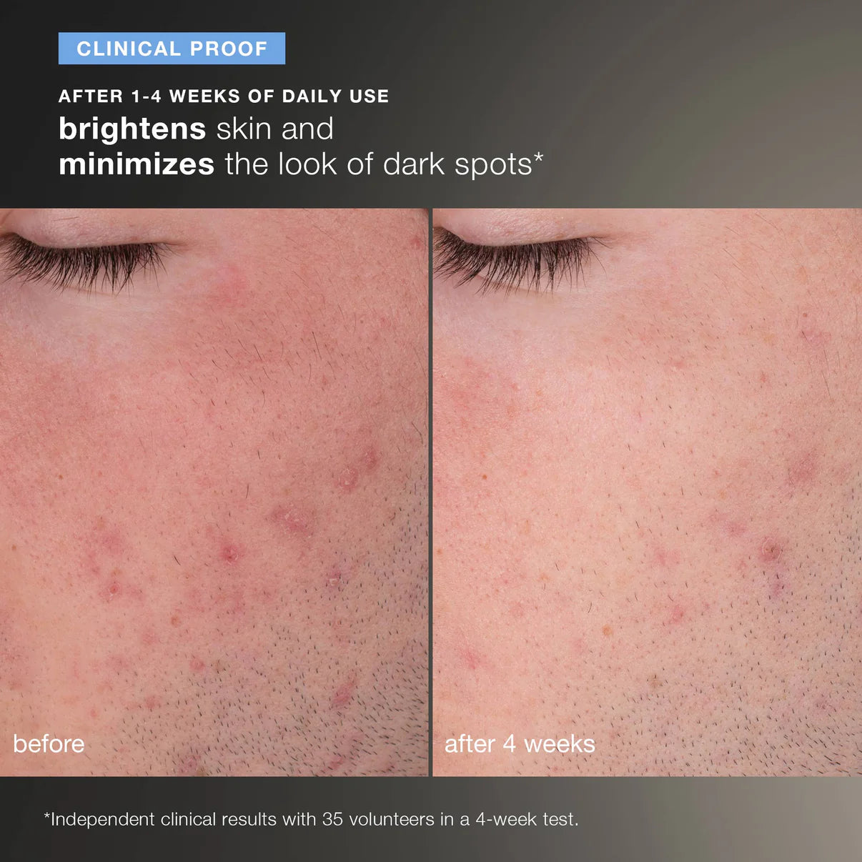 daily microfoliant exfoliator travel size