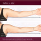 dynamic skin body sculptor