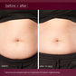 dynamic skin body sculptor