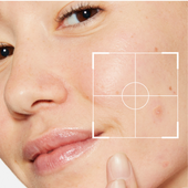 acné et imperfections