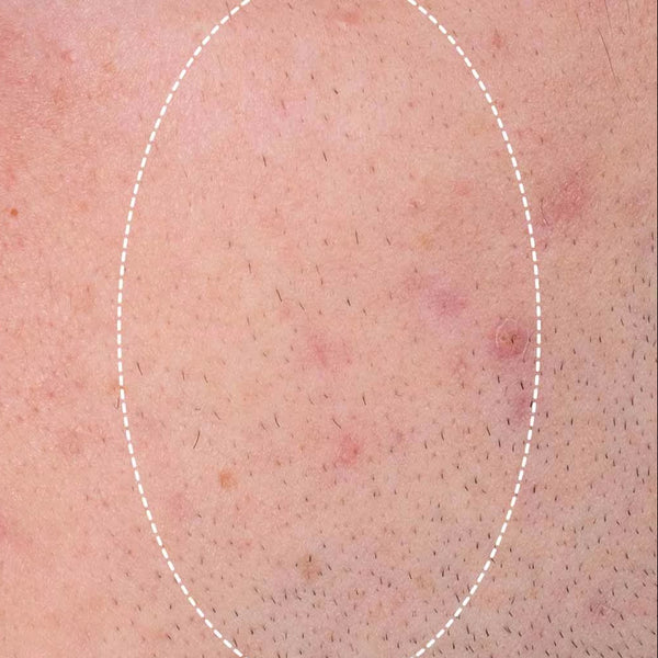 micro-exfoliant quotidien - After